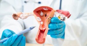 Postmenopause: Symptoms, Causes, Health Risks & How to Stay Healthy Naturally Postmenopause: Symptoms, Causes, Health Risks & How to Stay Healthy Naturally