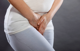 Vaginal Dryness During Menopause: What Causes It & What Nigerian Women Can Do About Vaginal dryness during menopause