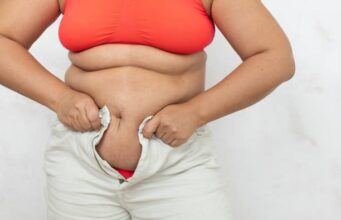 Menopause Weight Gain Is Real: How Nigerian Women Can Manage It Without Starving Themselves Menopause Weight Gain