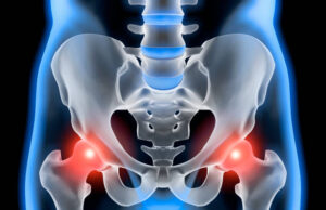 Osteoporosis and Menopause: Protecting Your Bone Health Naturally Osteoporosis and Menopause