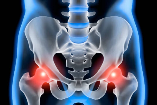 Osteoporosis and Menopause: Protecting Your Bone Health Naturally Osteoporosis and Menopause